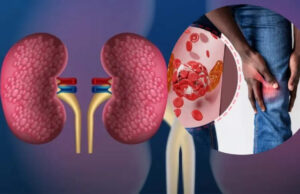 जिम जा रहे हैं तो सावधान! ज्यादा प्रोटीन से बन रही है बॉडी, लेकिन धीरे-धीरे खराब हो रही किडनी जानिए कैसे ?