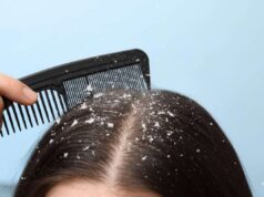 डैंड्रफ और खुजली का घरेलू इलाज: दही से तैयार करें 3 असरदार हेयर मास्क और पाएं सिल्की बाल